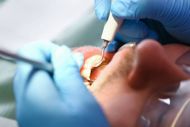 Best Broken or Cracked Tooth Emergency Dentist in Farmersville, TX