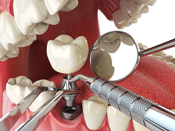Best Broken or Cracked Tooth Emergency Dentist in Farmersville, TX